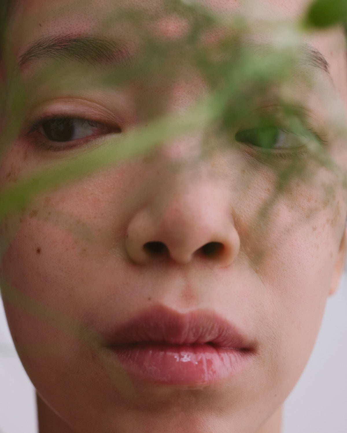Aloe and Acne: An Underrated Super Ingredient