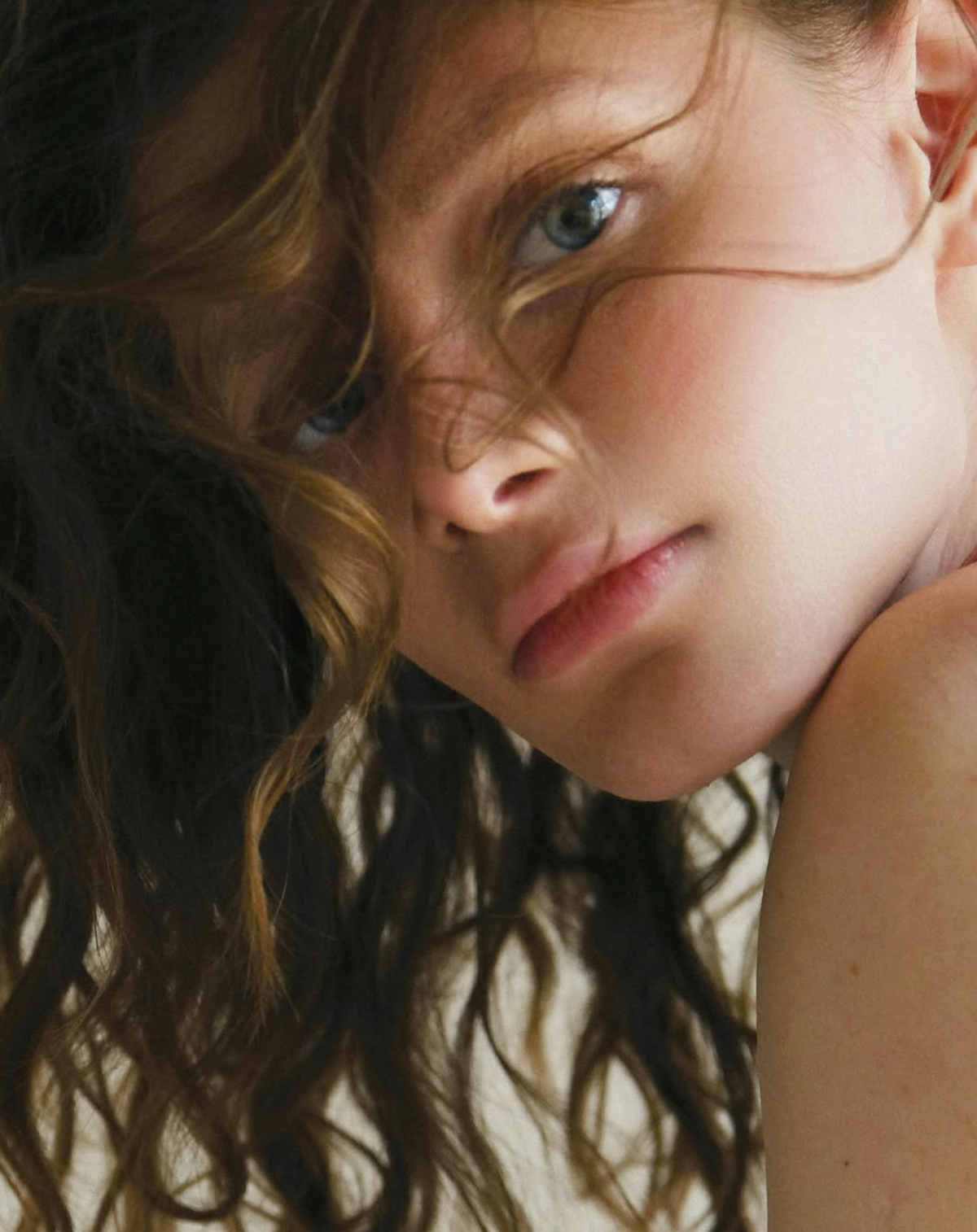 Why Acne Happens (And What Your Skin Is Trying to Tell You)